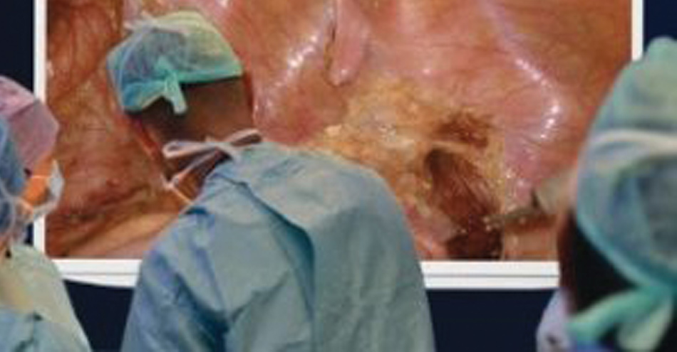 Olympus Introduces Big Screen Surgery In 4K