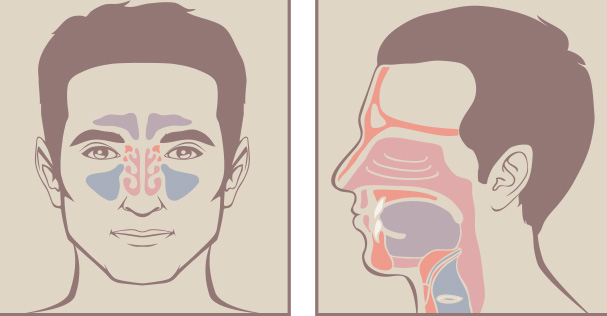 Learn How to Spot and Treat Sinusitis