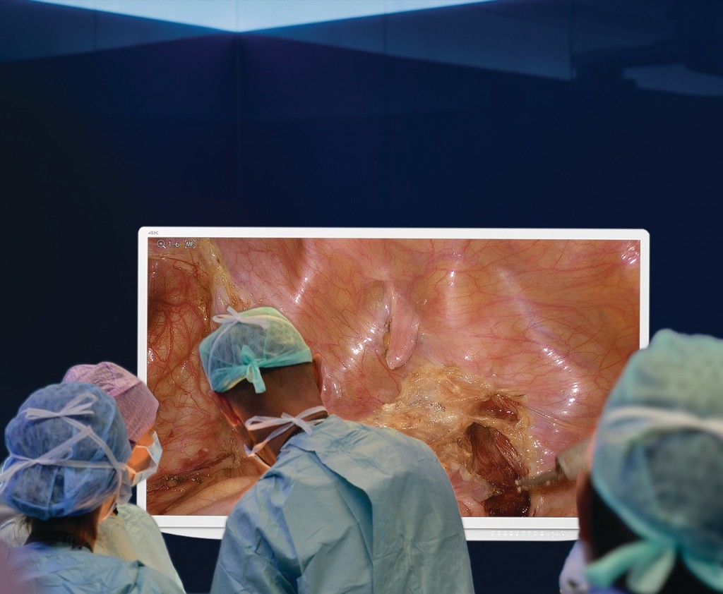 Olympus Unveils Big Screen Surgery In 4K