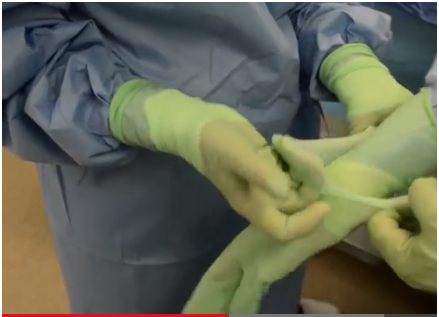 New Study Proves Antimicrobial Gloves Help Reduce SSI Risk