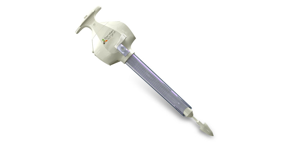 TroClose1200 Access-Closure System Used in 2,000+ Surgeries