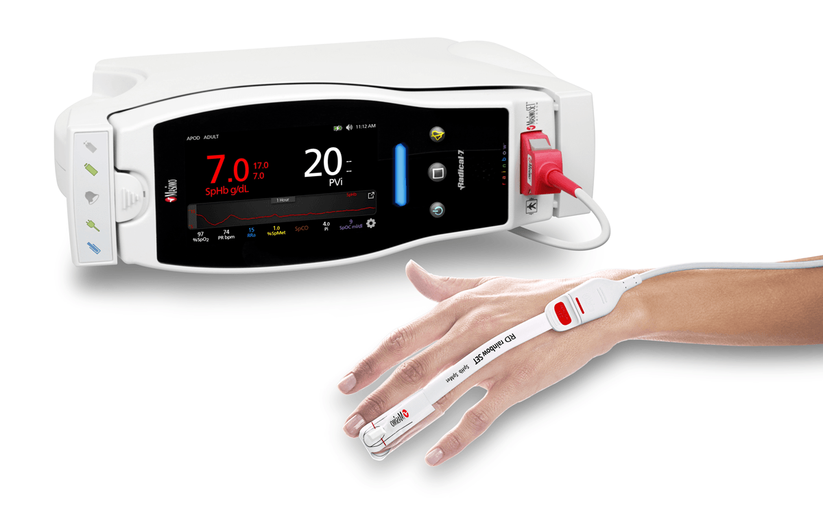 New Study Evaluates Ability of Masimo SpHb® (Noninvasive Hemoglobin) to Estimate Timing for Invasive Measurement to Detect Anemia During Surgery