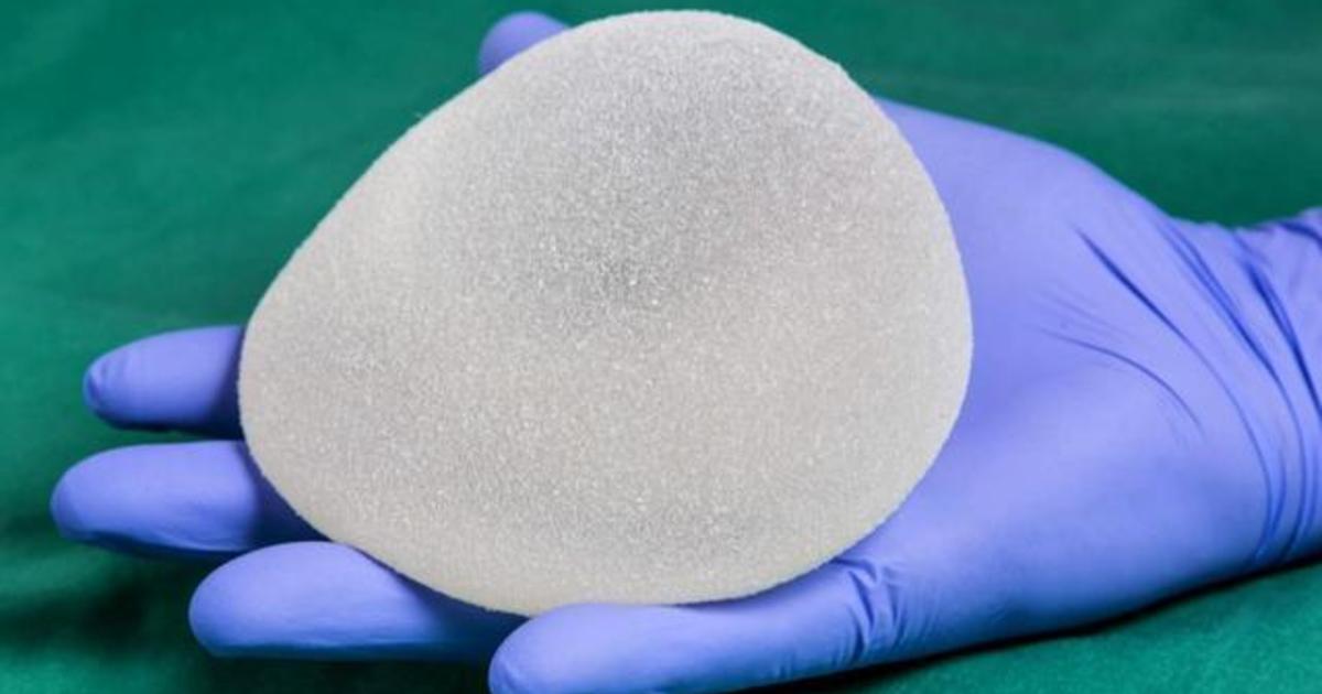 Allergan Voluntarily Recalls BIOCELL® Textured Breast Implants and Tissue Expanders