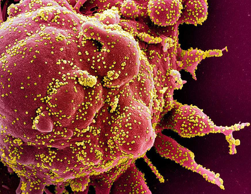 NIH study validates decontamination methods for re-use of N95 respirators