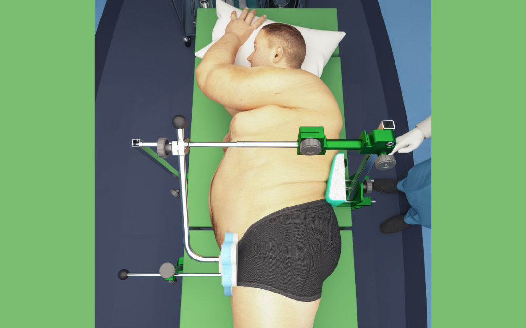 IMP De Mayo Exact-Fit Lateral Positioner