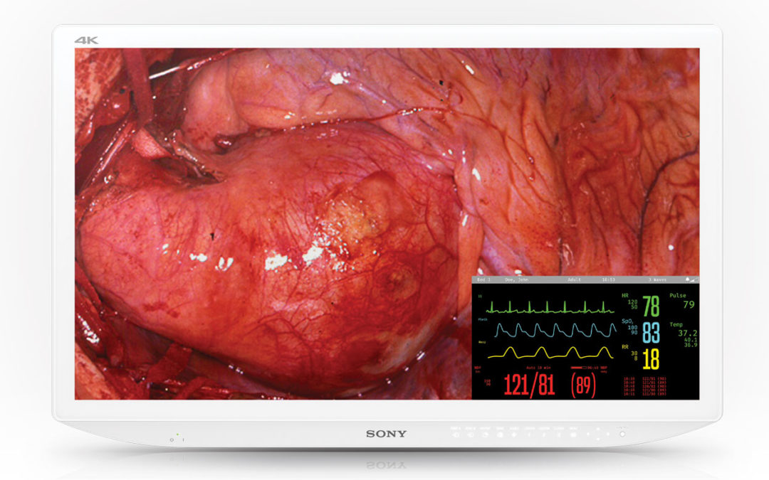 Sony Expands Lineup of 4K Medical Monitors