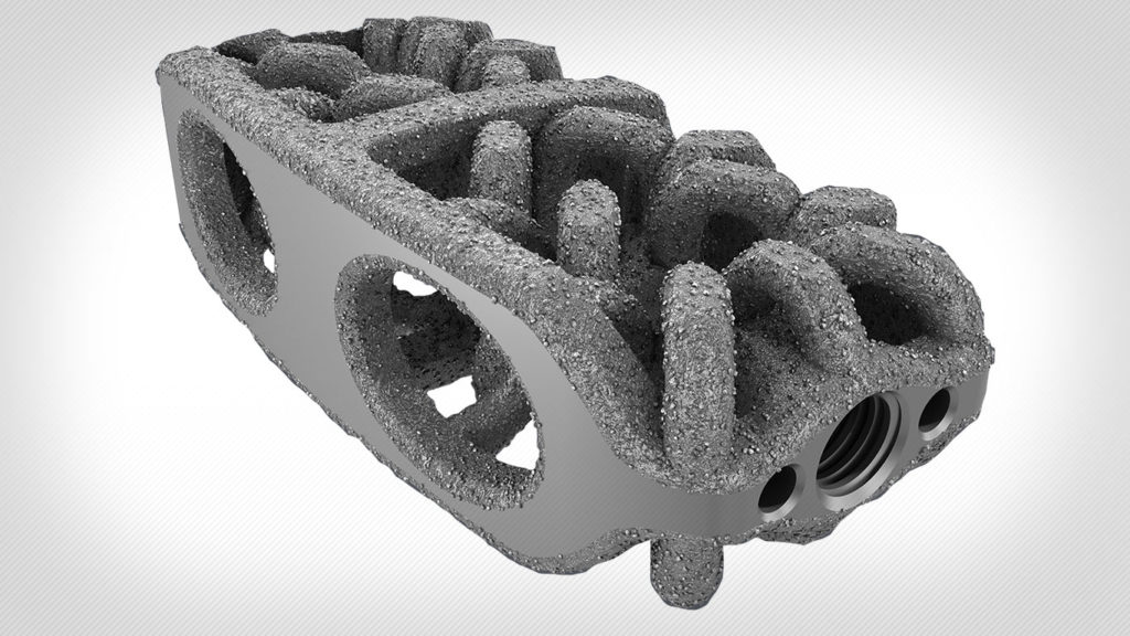 Camber Spine Expands Patent Portfolio with SPIRA Lateral 3.0