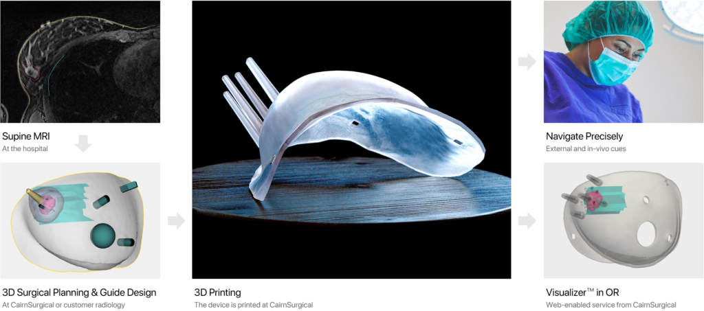 Breast Cancer Locator™ (BCL™) 