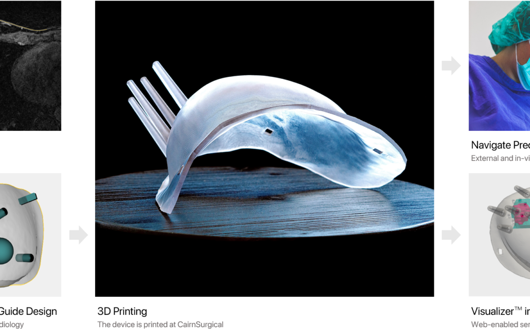 First Patient Treated in Clinical Trial of BCL System