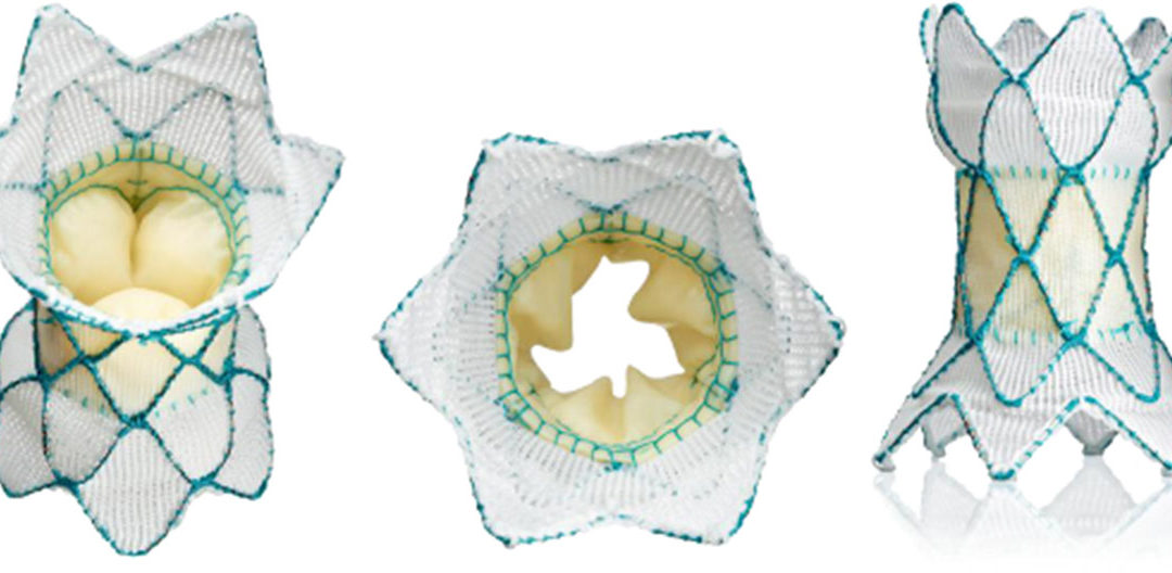 FDA Approves First in the World Device to Treat Patients with Congenital Heart Disease