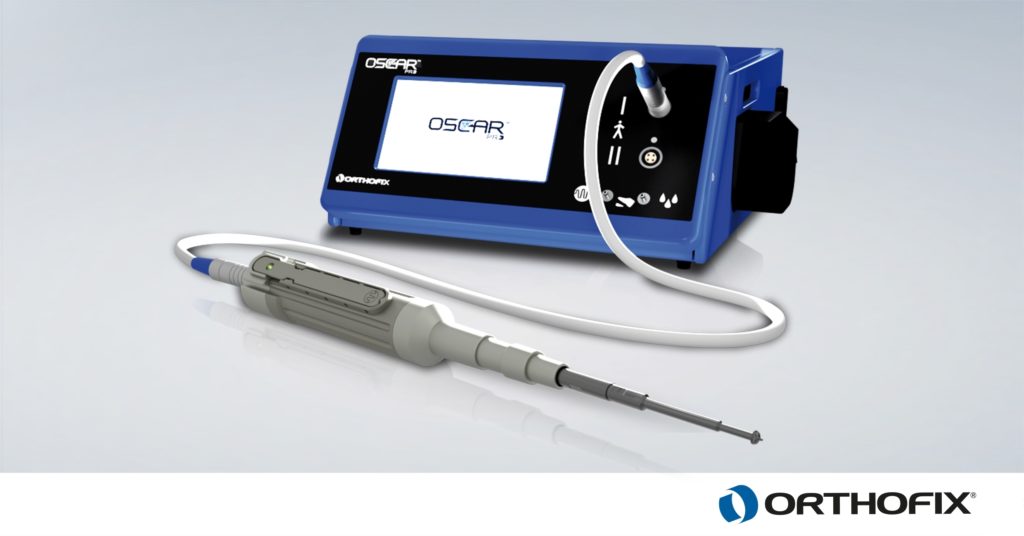 Orthofix Launches OSCAR PRO System for Removal of Cement During Complex Joint Revision Surgeries