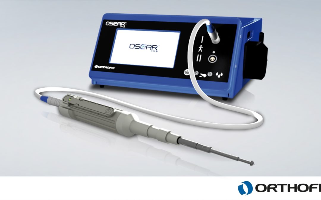 Orthofix Launches OSCAR PRO System for Removal of Cement During Complex Joint Revision Surgeries