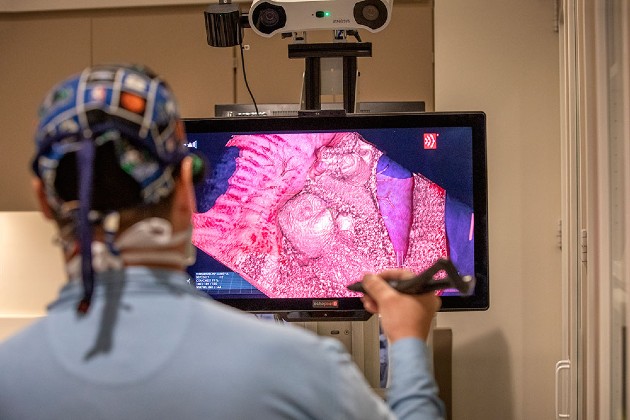 CentraCare Uses 4D Hologram Technology for Heart Procedure
