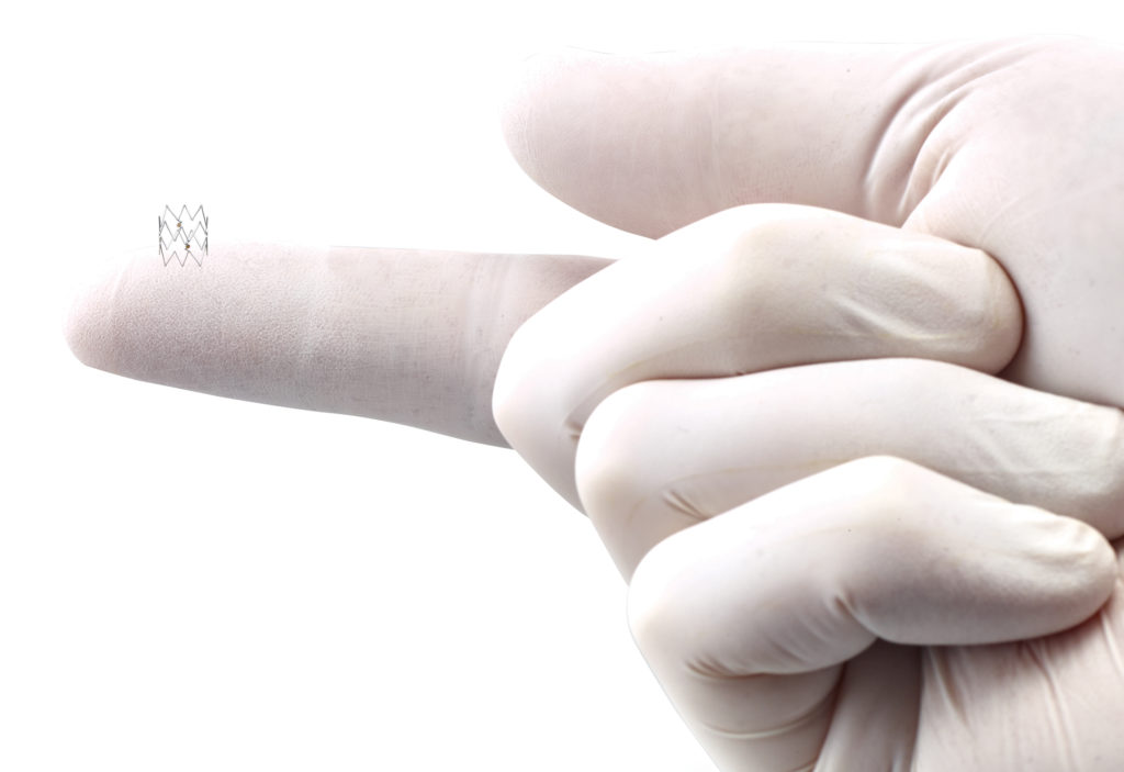 TOBA II BTK Clinical Trial Demonstrates Durability of Dissection Repair Below Knee with Philips Tack Endovascular System