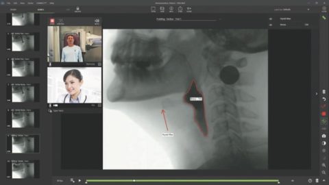 TIMS Medical Releases TIMS Connect | OR Today