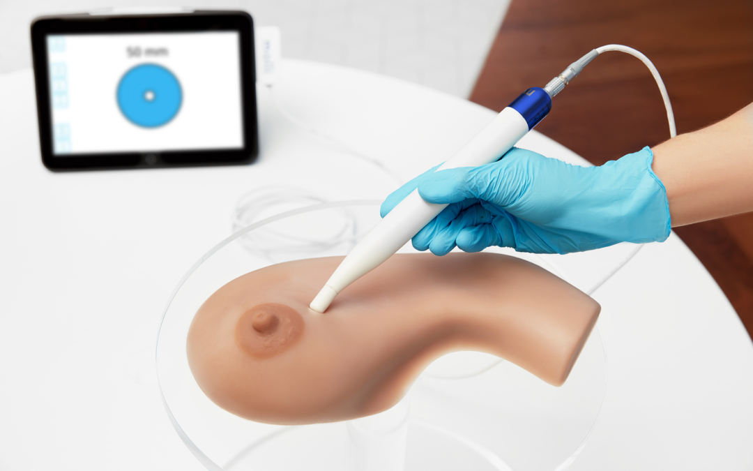 MOLLI Surgical Launches Products to Simplify Breast Cancer Surgery, Improve Patient Experience