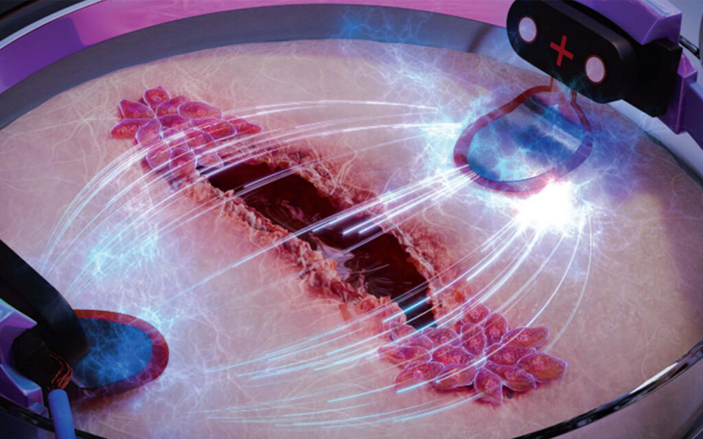 Electricity Can Heal Wounds Three Times as Fast