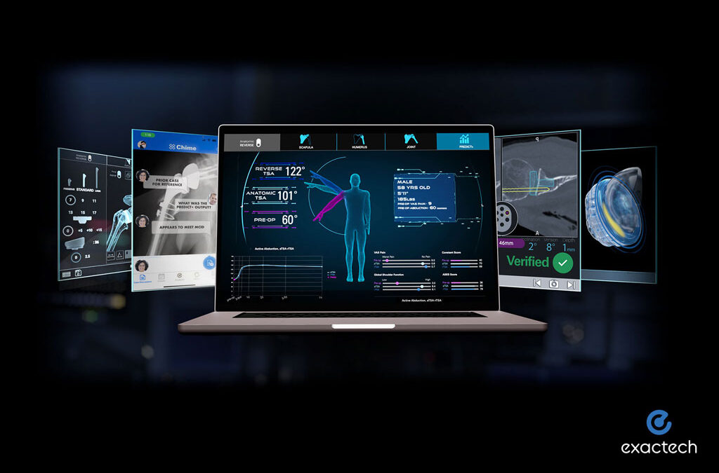 Orthopaedic Surgeon First to Use Machine Learning to Predict Outcomes for Shoulder Replacements in Boston