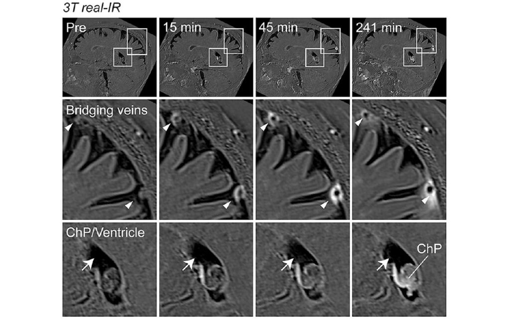 Links Discovered Between Brain and Environment