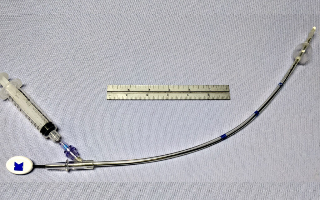 Kapp Surgical
MICHLER Heart Vent Catheter (MHVC)