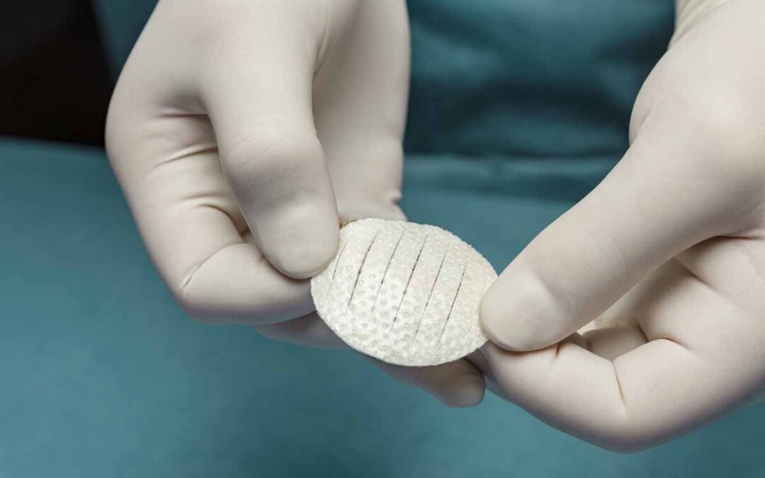 Kerecis Shield Standard