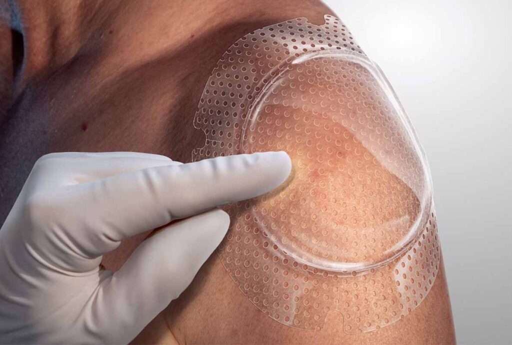 Optiview Blanch illustration