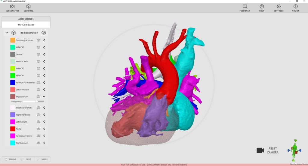 Rady Children’s Launches No-Cost 3D Model Viewing Technology