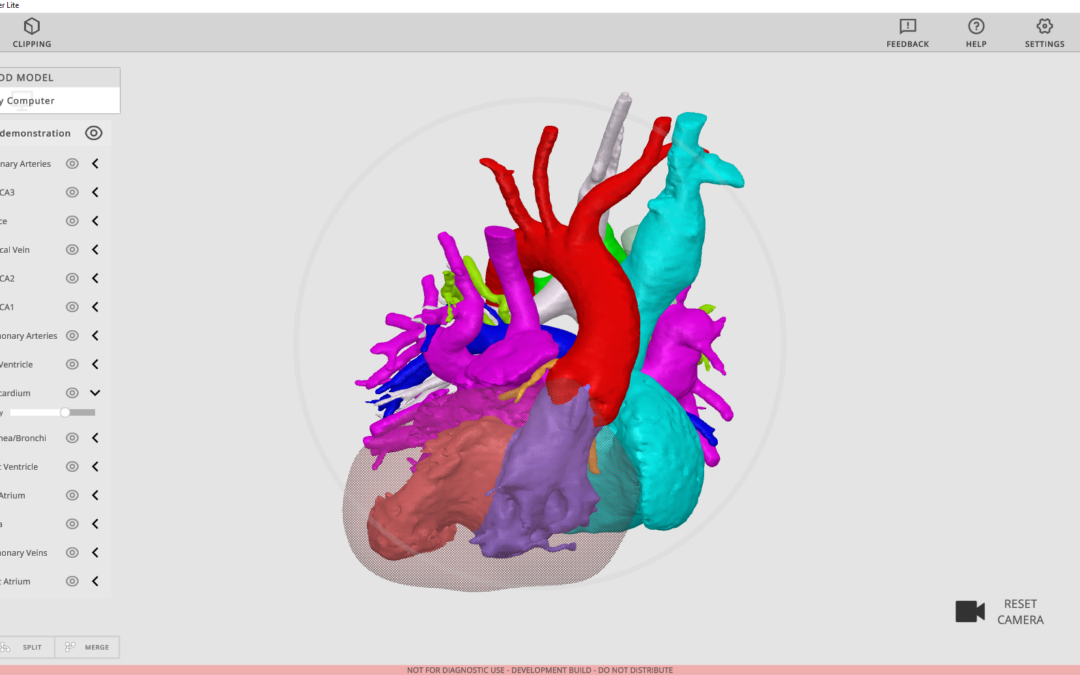 Rady Children’s Launches No-Cost 3D Model Viewing Technology