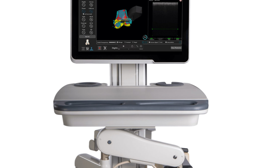Smith+Nephew partners with JointVue™ for Ultrasound preoperative planning in robotics-assisted surgery