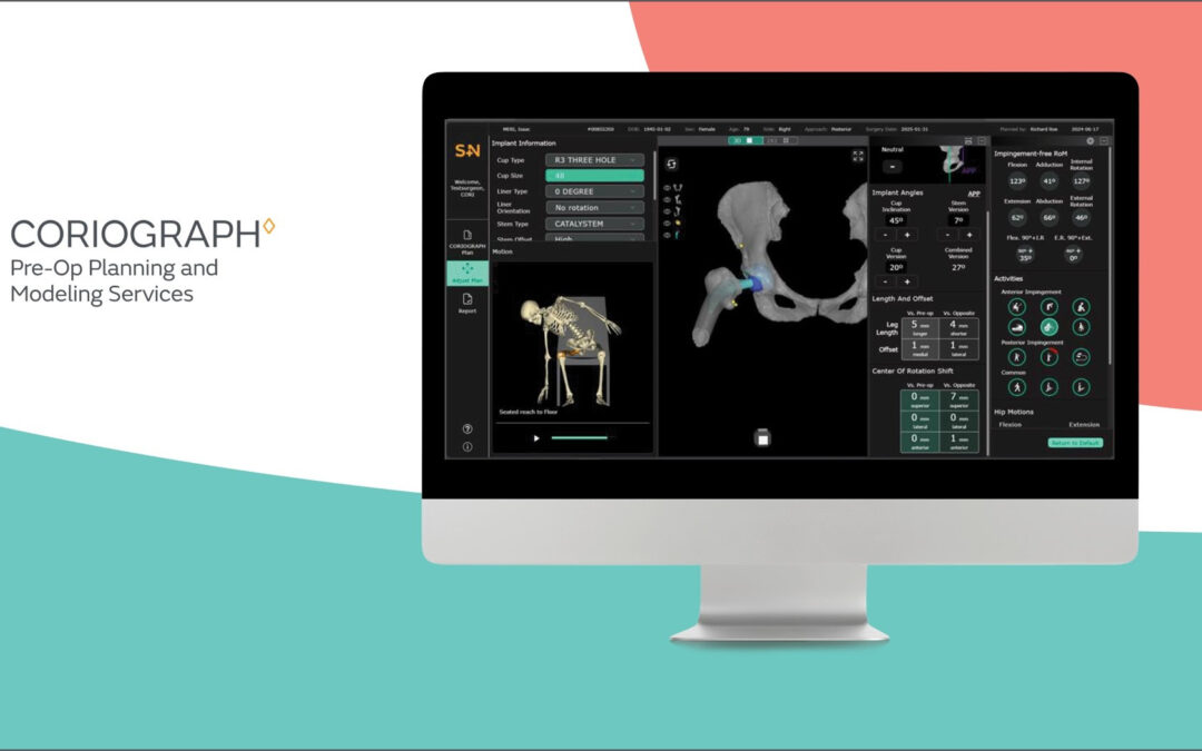 Smith+Nephew introduces CORIOGRAPH Pre-Op Planning and Modeling Services for Total Hip Arthroplasty