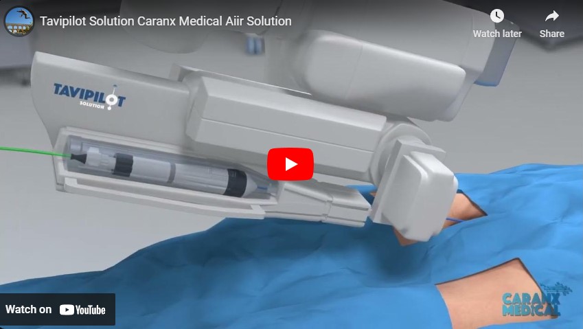 Caranx Medical Announces FDA Submission of TAVIPILOT Soft