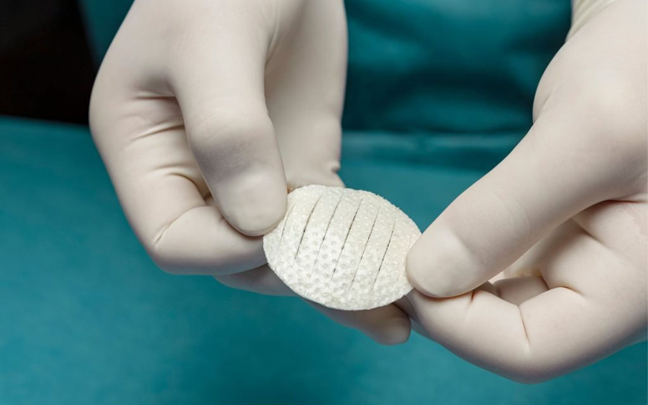 Kerecis
Shield Standard
