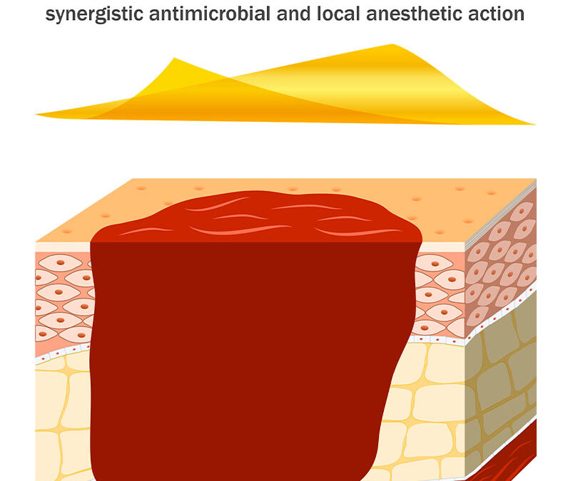 Imbed Biosciences Microlyte Ag/Lidocaine