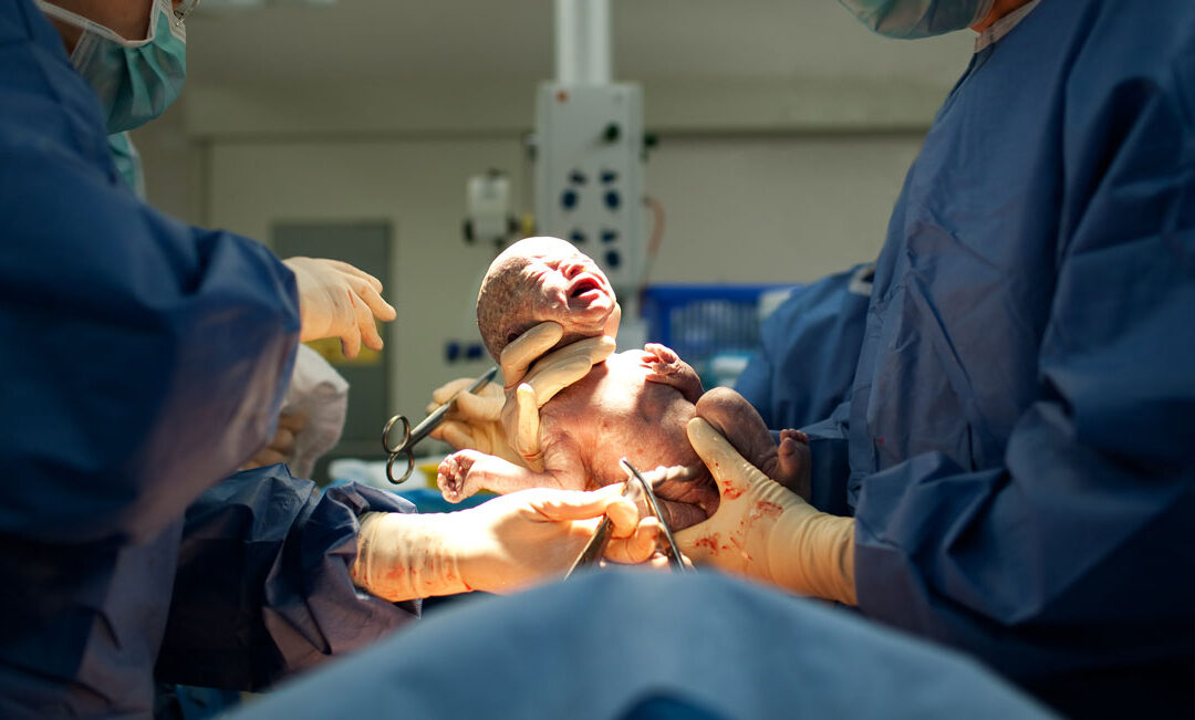 Assessing Severe Surgical Complications from Cesarean Deliveries