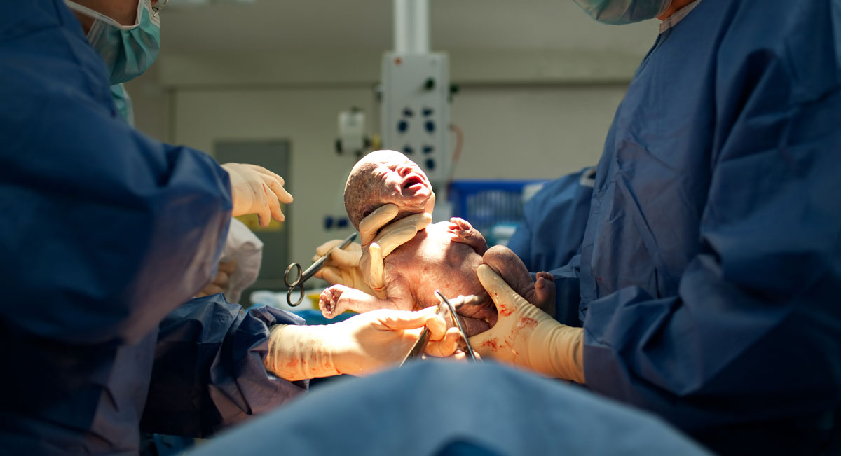 Assessing Severe Surgical Complications from Cesarean Deliveries
