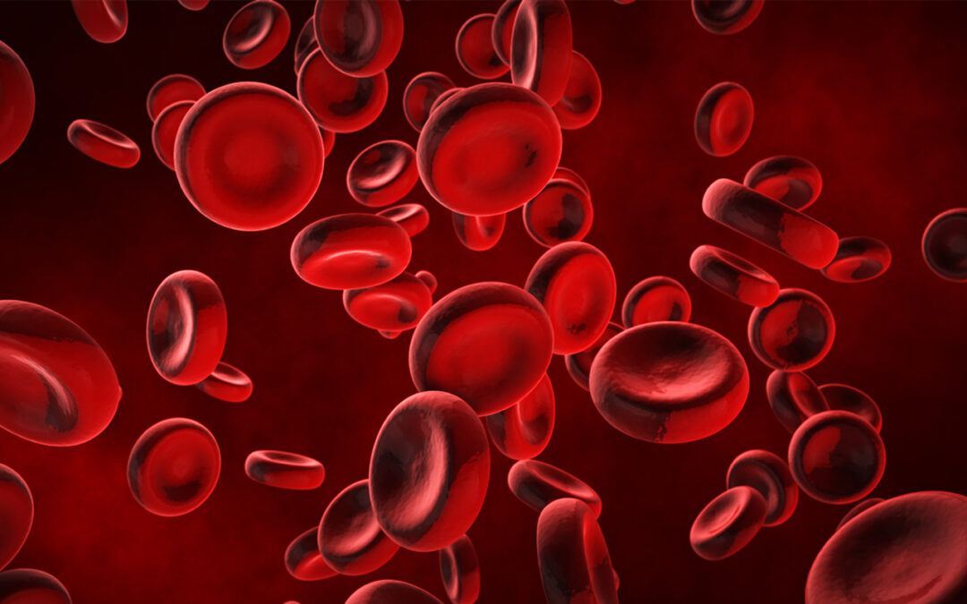 Study Highlights Better Healing Outcomes for Pressure Ulcers