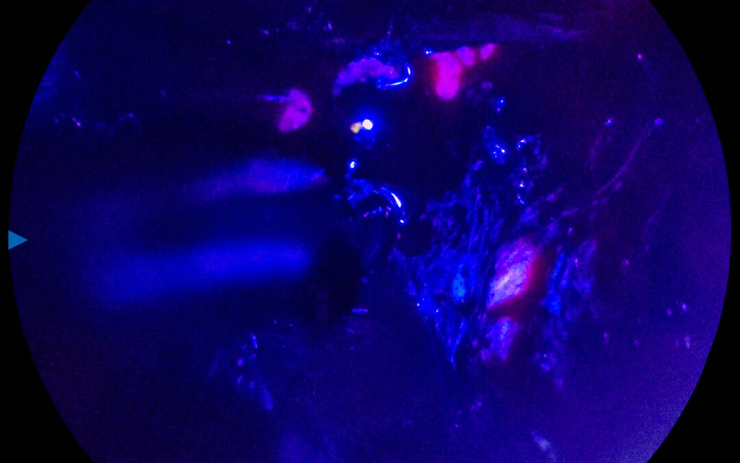 Viseon Announces First Human Use of Hubble EXCITE