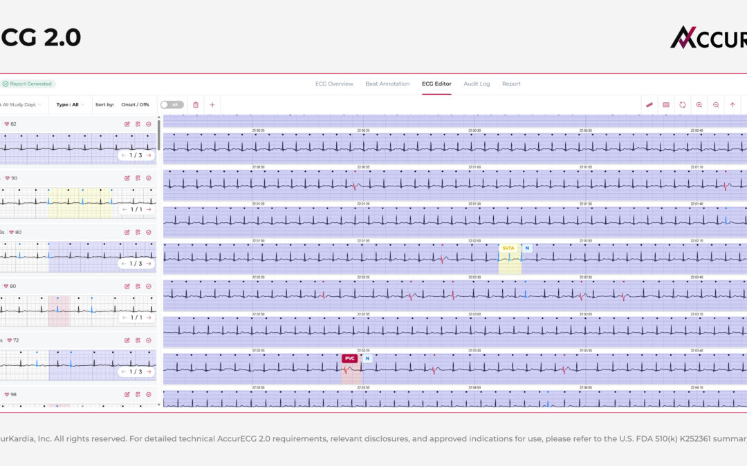 AccurKardia Launches AccurECG 2.0