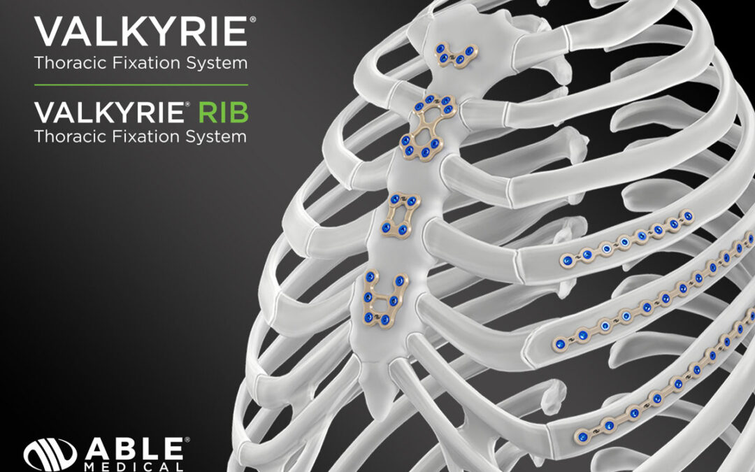 Able Medical to Showcase PEEK Sternal Closure System