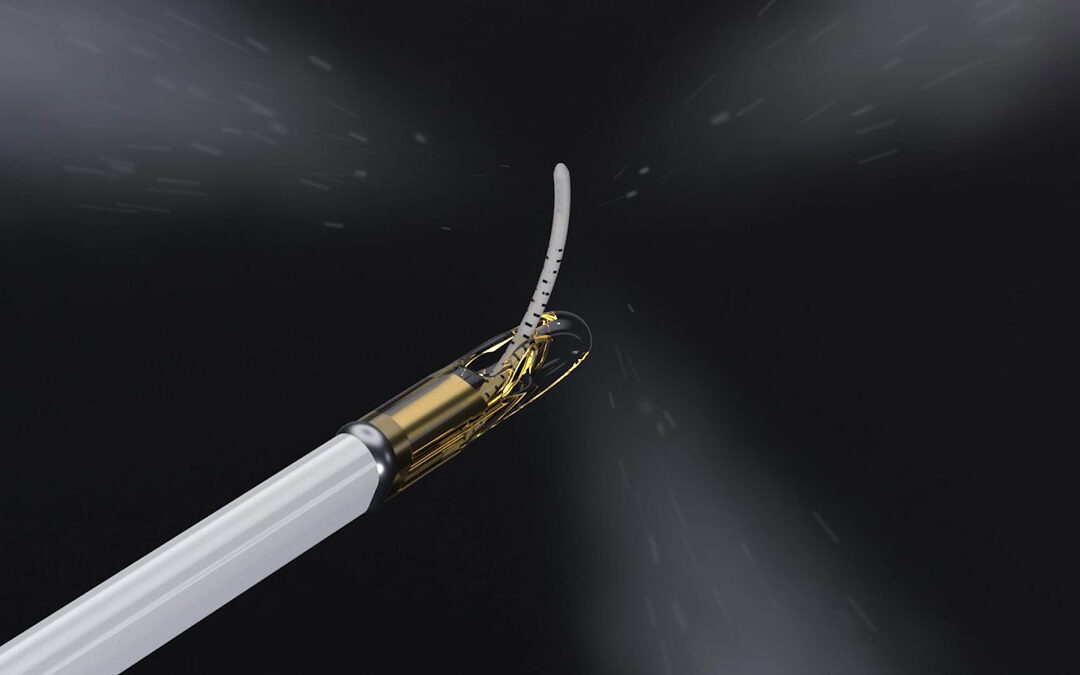 Urologist Performs Prostate Tissue Ablation with Vanquish Water Vapor System