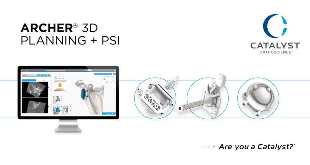 Catalyst OrthoScience Announces FDA 510(k) Clearance of Archer Patient-Specific Instrumentation for Shoulder Arthroplasty
