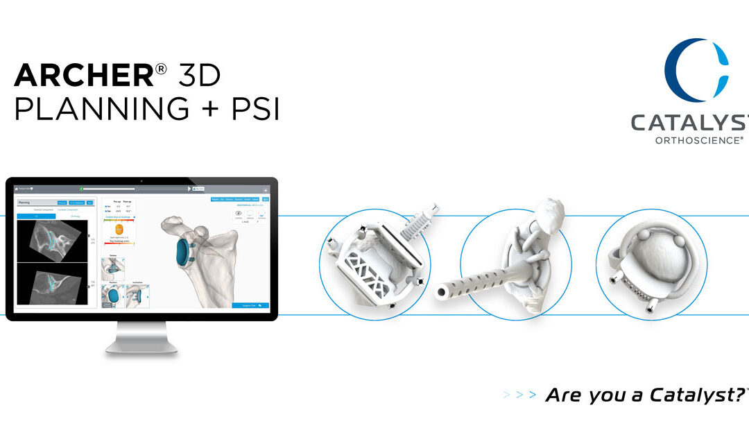 Catalyst OrthoScience Announces FDA 510(k) Clearance of Archer Patient-Specific Instrumentation for Shoulder Arthroplasty