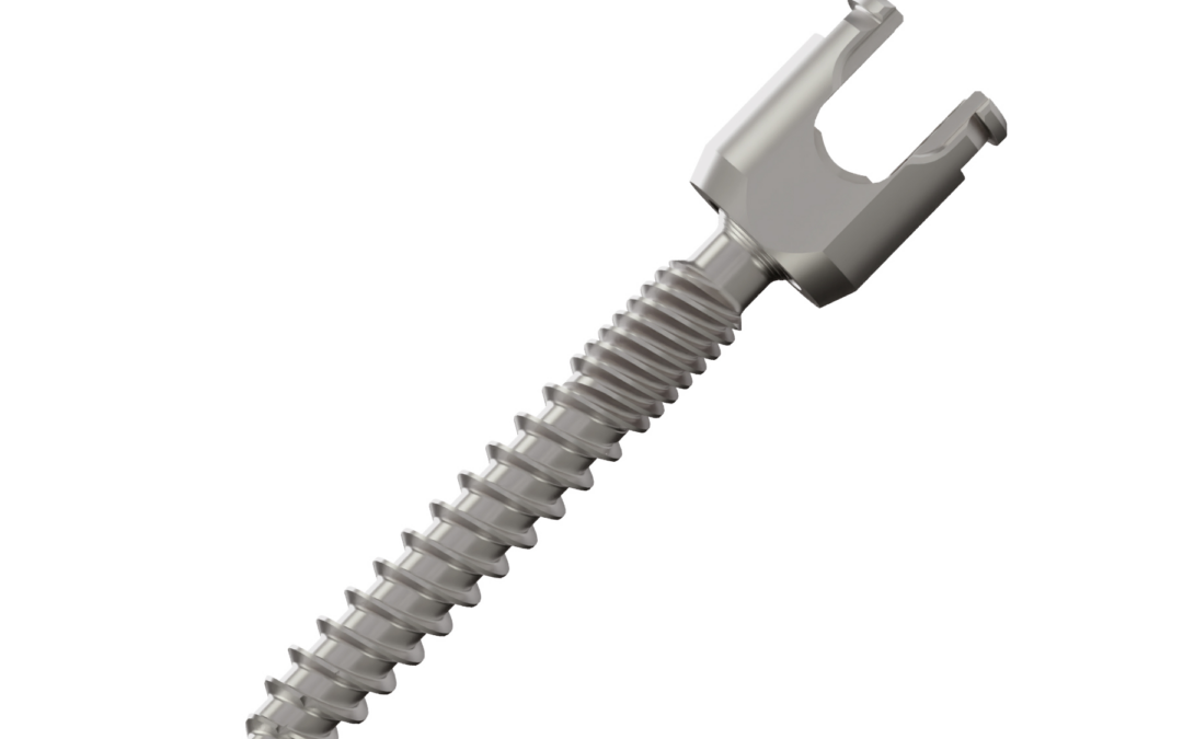 VB Spine Announces Successful First Clinical Cases of Vulcan Spinal System