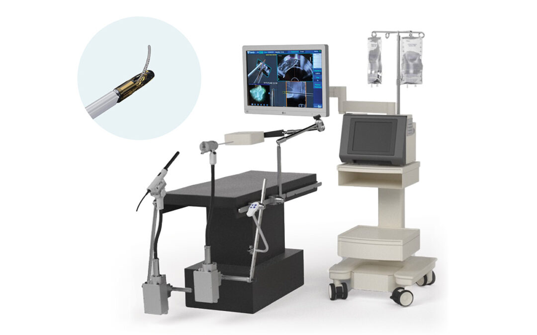 Francis Medical Inc. Vanquish Water Vapor Ablation System