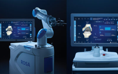 ROSA ROSA Knee with OptimiZe