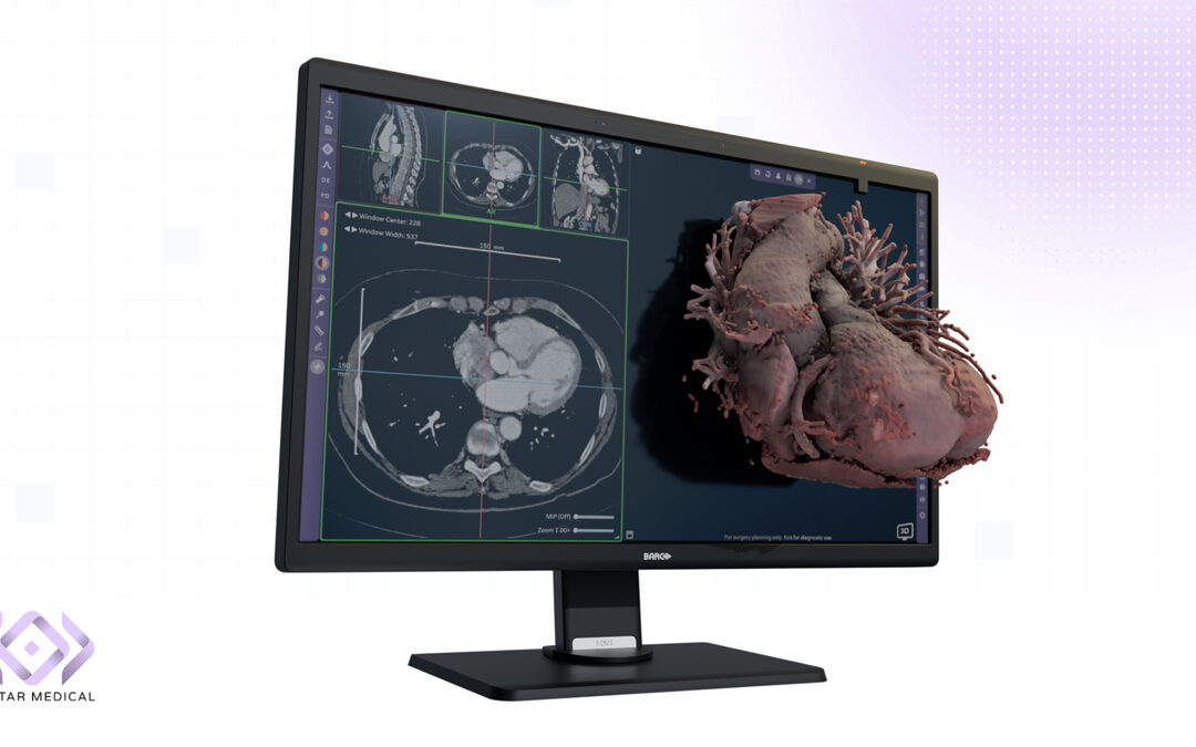 First Software Cleared for Use with Glasses-Free 3D Medical Displays