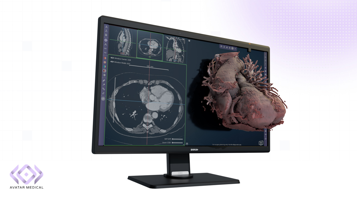First Software Cleared for Use with Glasses-Free 3D Medical Displays

