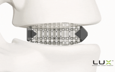 Xenix Medical Announces FDA Clearance and Full Commercial Launch of the Lux Expandable Lumbar Interbody Fusion System